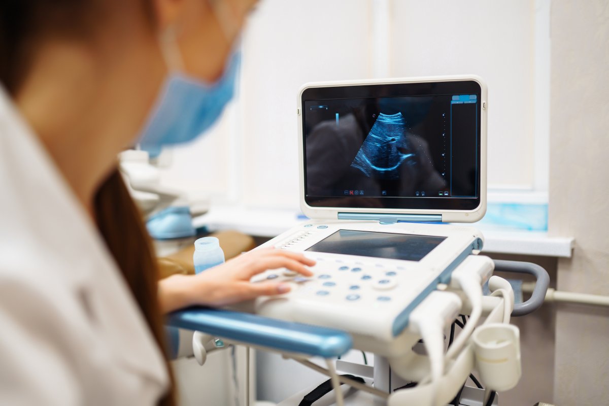 Doctor using ultrasound machine